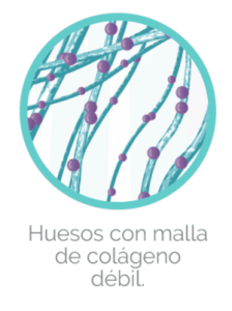 huesos debiles